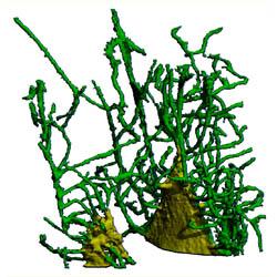 Internal structure of bone (by Philipp Schneider)