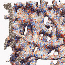 Trabecular bone (by Aura Maria Cardona Ochoa)